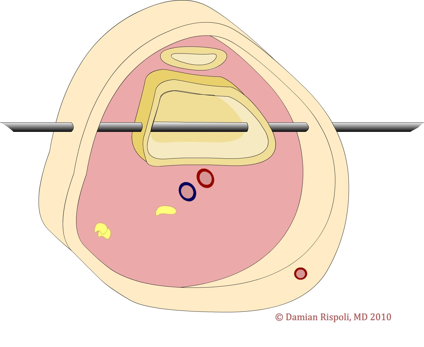 Wheeless' Textbook of Orthopaedics